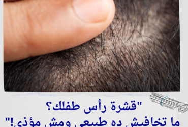 قشرة رأس طفلك؟ ما تخافيش ده طبيعي ومش مؤذي!"